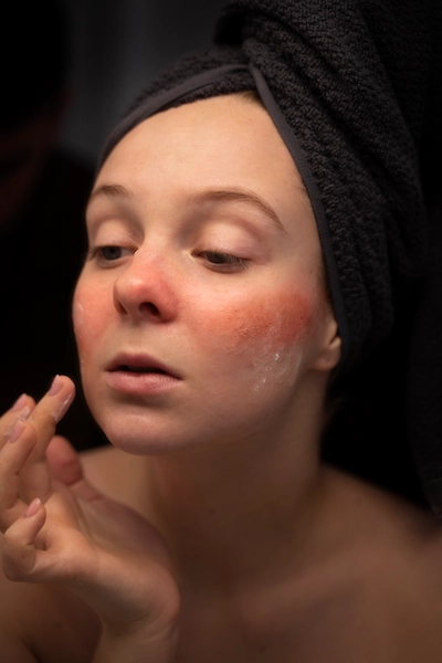 kuru ciltler için serum