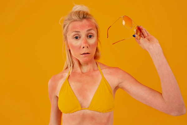 Güneş Kremi Cilt Lekelerini Önler mi