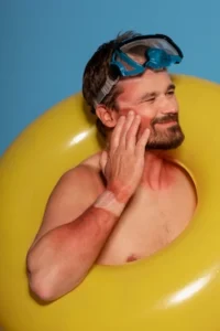 güneş yanığı kaşıntısı nasıl geçer