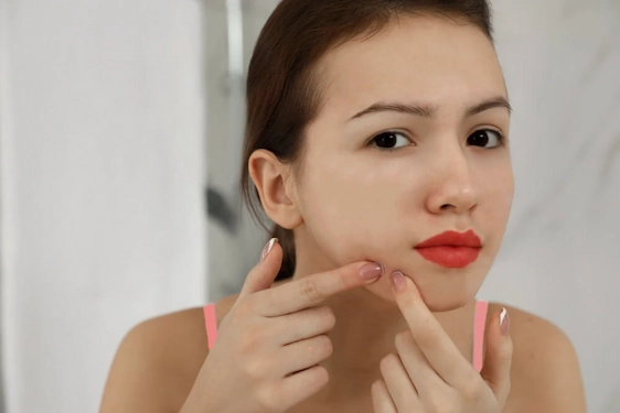 Akneli Ciltler İçin SPF 50 Güneş Kremi